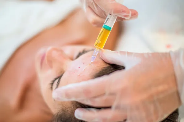 Platelet-Rich Plasma Face Treatments